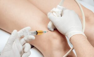 Read to Know If It is the Right Time to Offer Platelet-Rich Plasma (PRP) in Your Medical Practice